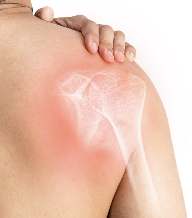 Dr.Sebastián Vázquez-Traumatólogo especialista en hombro y deportiva