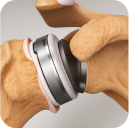 Dr.Sebastián Vázquez-Traumatólogo especialista en hombro y deportiva